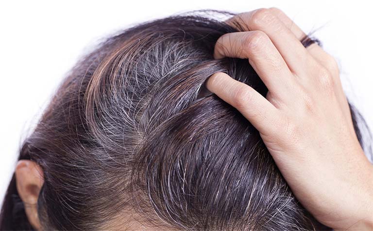 14 bài thuốc dân gian trị tóc bạc sớm hiệu quả từ các thảo dược