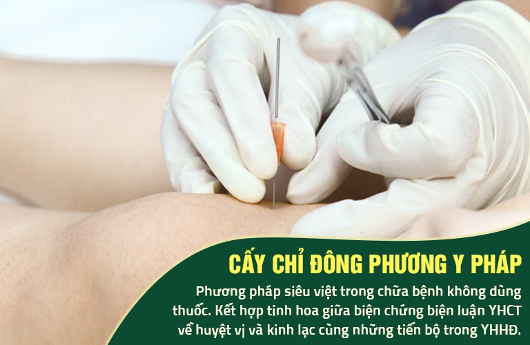 Cấy chỉ Đông phương Y pháp