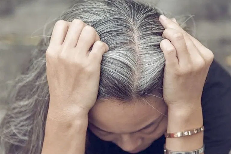 Tuy không phải là căn bệnh nguy hiểm nhưng tóc bạc sớm khiến không ít người mất tự tin khi tiếp xúc với đám đông