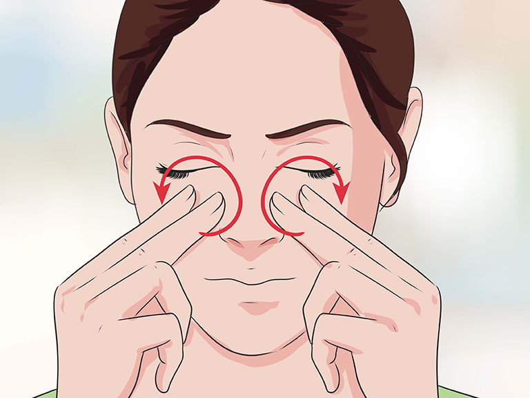 Polyp mũi không chỉ gây đau mũi mà còn kéo theo những cơn đau quanh vùng mũi và lan ra vùng thái dương
