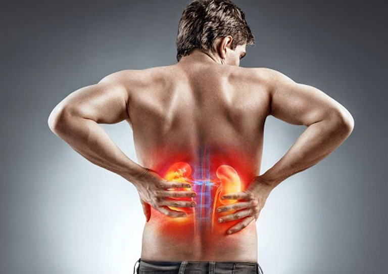 Đau nhức mỏi lưng thường xuyên là một trong những triệu chứng bệnh thận
