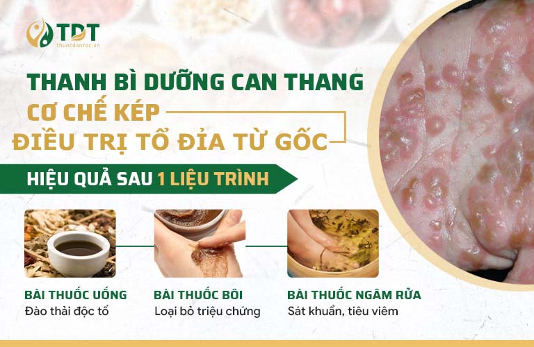 3 nhóm thuốc xử lý chuyên sâu bệnh tổ đỉa