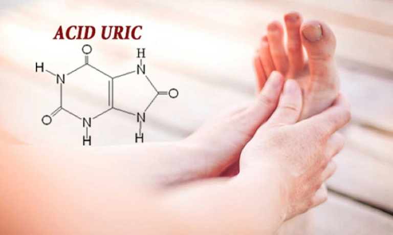 Acid uric cao gây sưng đau gout